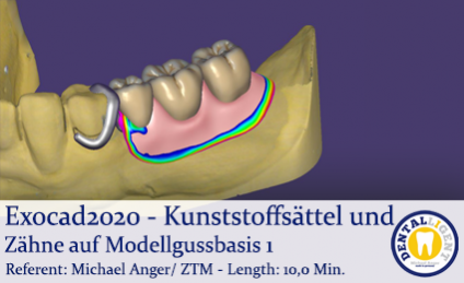 DENTALLIGENT 2020 Exocad Exocad Plovdiv Mundscans 3 Glieder