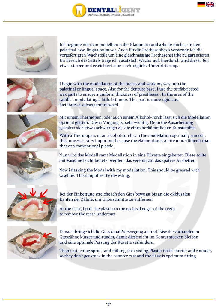 Werdegang einer ValplastProthese Teil 3 How to make a Valplast