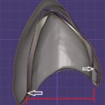 Das Konuskop® Doppelkronentechnik neu gedacht