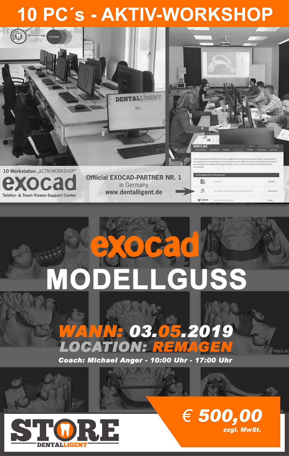 Exocad-Modellguss by Michael Anger - 10 PC´s AKTIV WORKSHOP - in REMAGEN