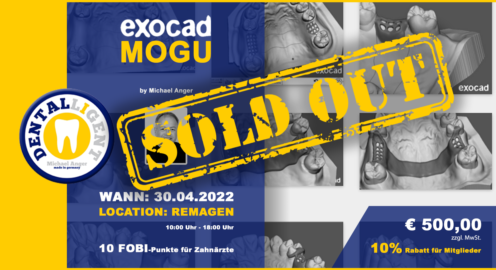 Exocad-Modellguss by Michael Anger - 10 PC´s AKTIV WORKSHOP
