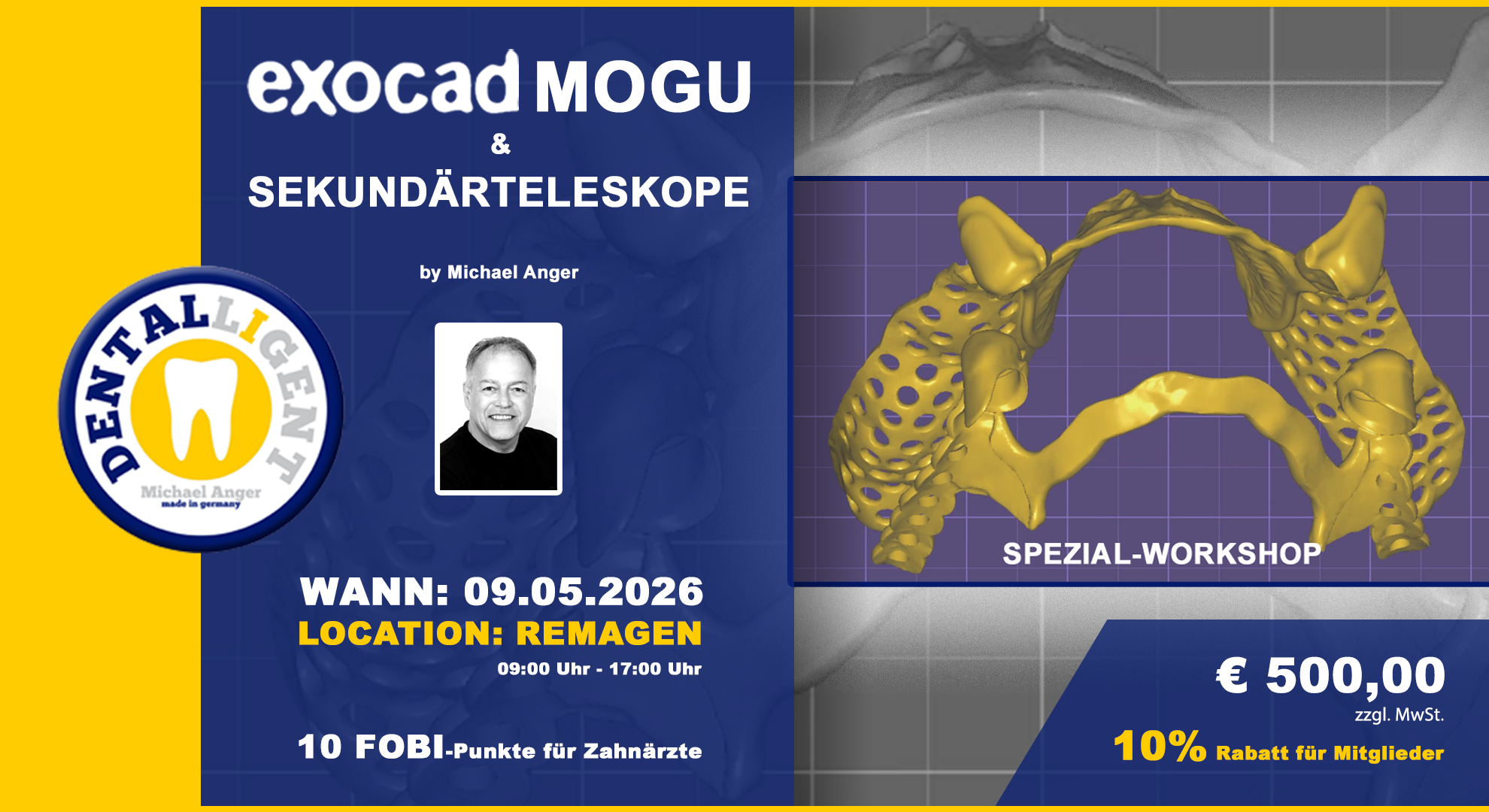 EXOCAD Modellguss & Sekundärteleskope aktiv Workshop