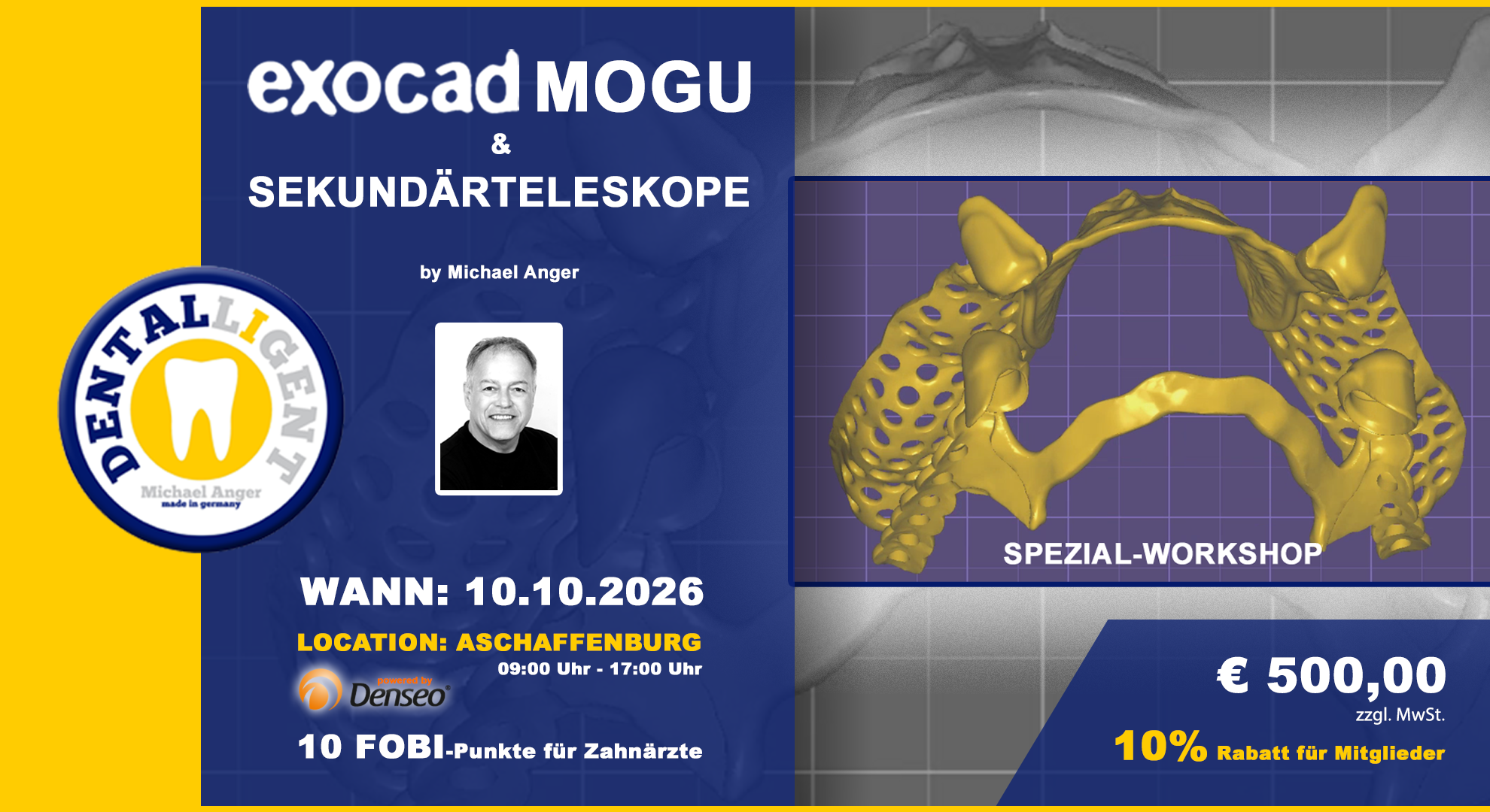 EXOCAD Modellguss & Sekundärteleskope in Aschaffenburg - aktiv Workshop