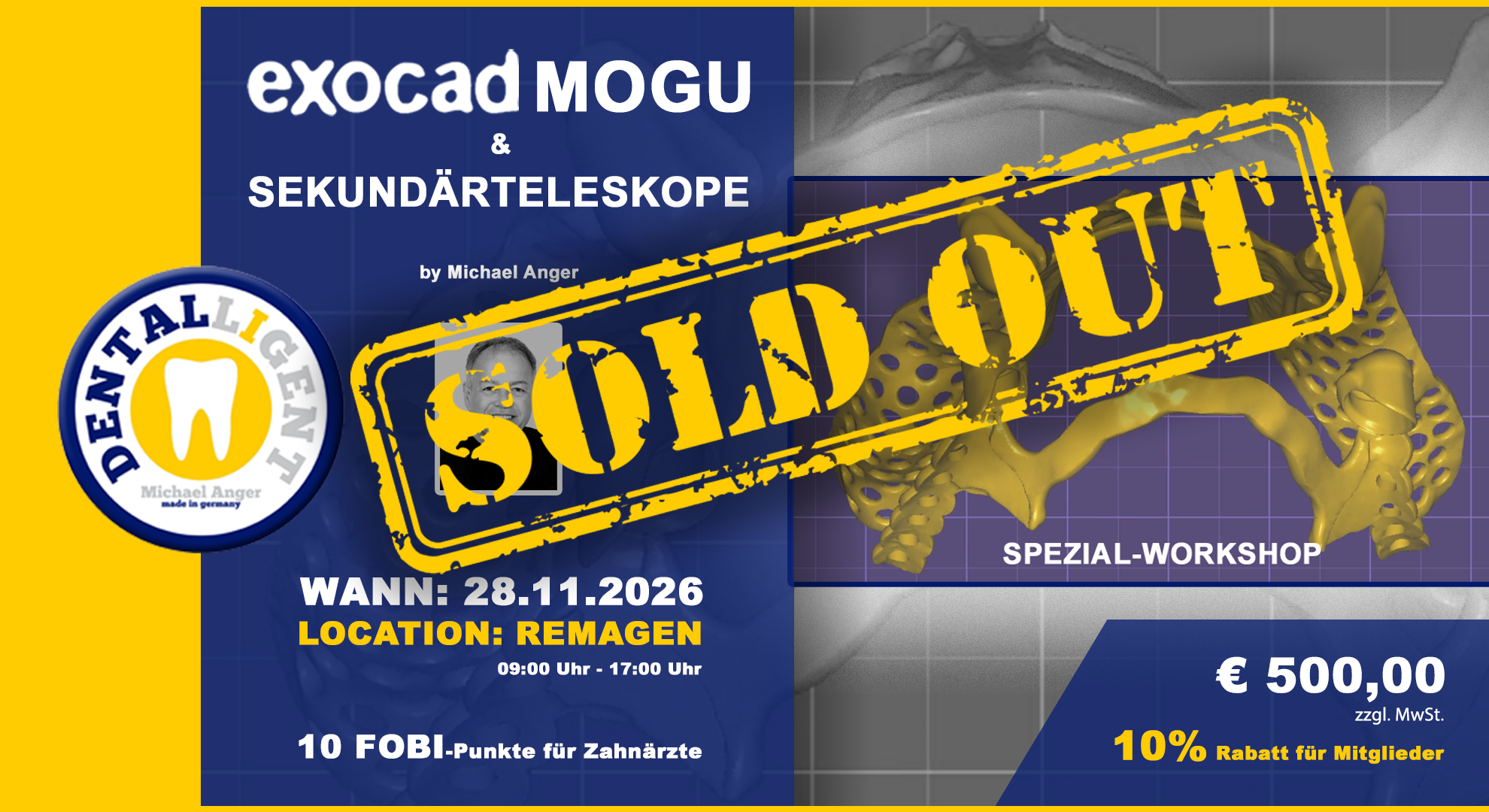 AUSVERKAUFT! EXOCAD Modellguss & Sekundärteleskope aktiv Workshop
