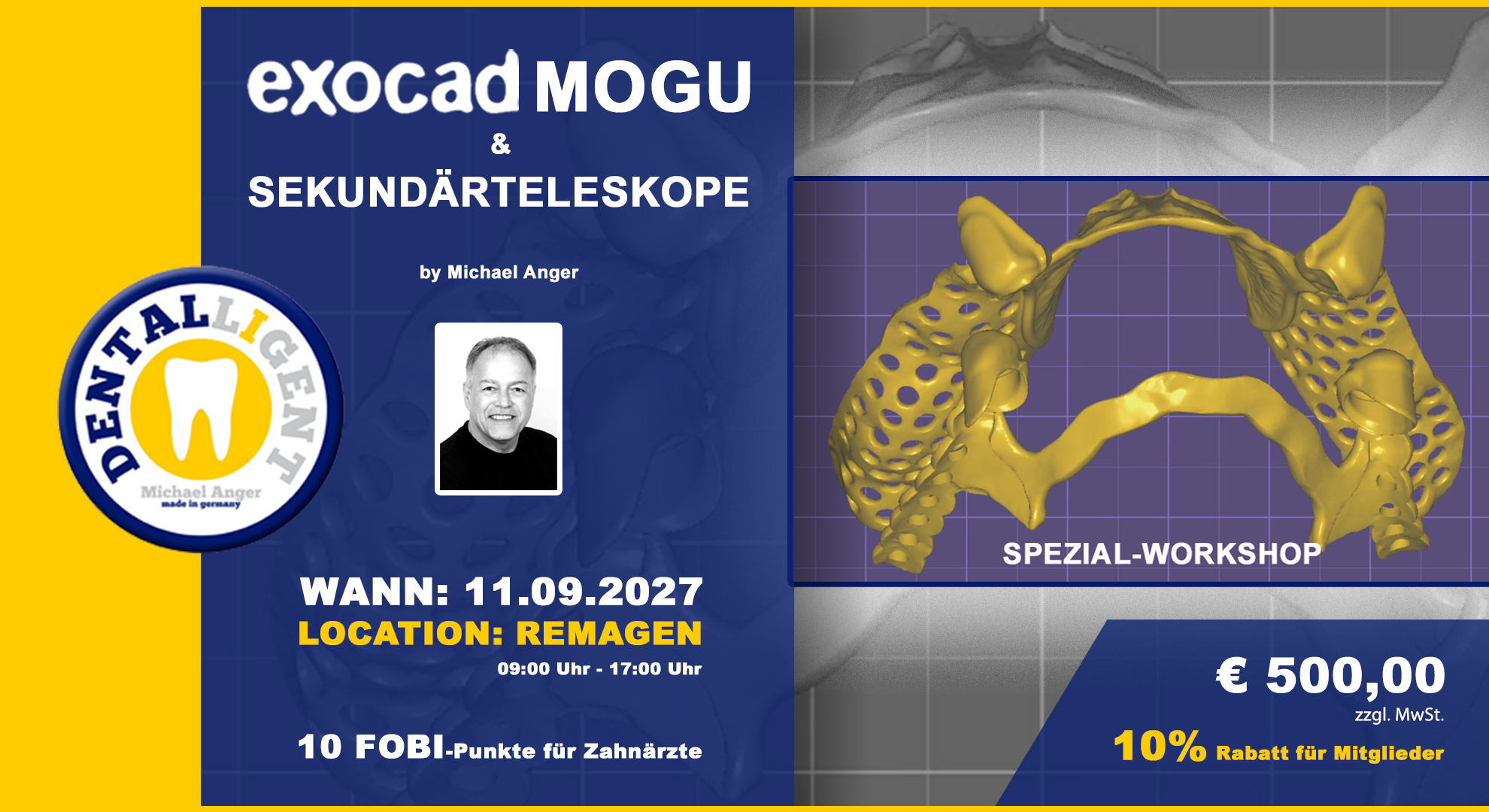 EXOCAD Modellguss & Sekundärteleskope aktiv Workshop