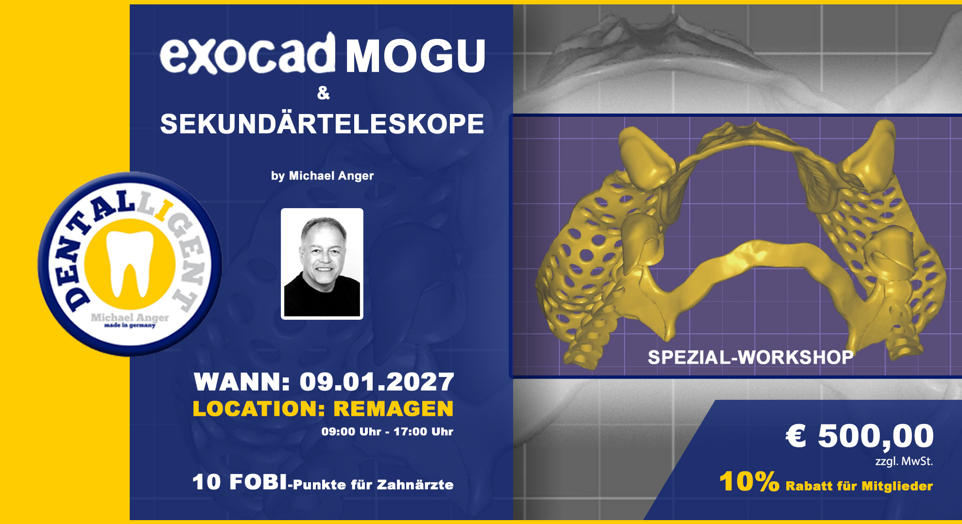 EXOCAD Modellguss & Sekundärteleskope aktiv Workshop