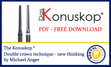 The Konuskop® - double crown technique 